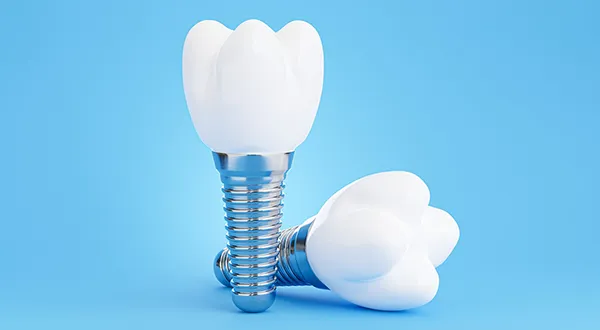 The Role of Materials in The Success of Dental Implants