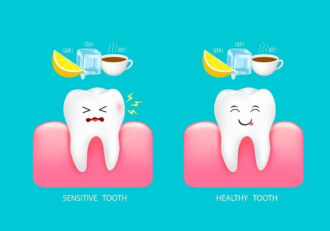 Common Symptoms of Sensitive Teeth