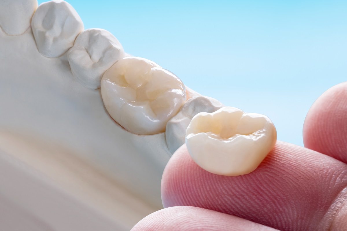 closeup-prosthodontics-prosthetic-single-teeth-crown-bridge-equipment-model-express-fix-restoration.jpg