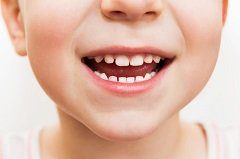 Special Care for Kids' Teeth